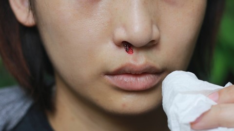 Ilustrasi ibu hamil mimisan. Foto: Wonderplay/Shutterstock