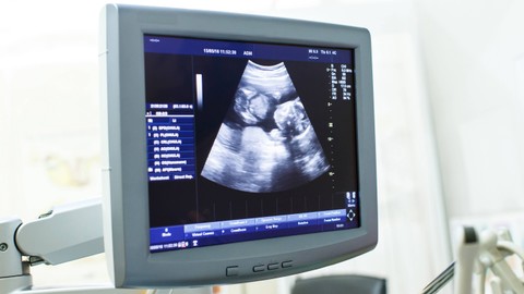 Ilustrasi USG bayi. Foto: ANUCHIT MANMAI/Shutterstock