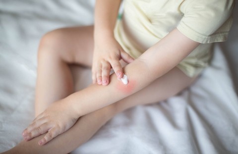 Ilustrasi luka  pada anak.  Foto: HENADZI KlLENT/shutterstock
