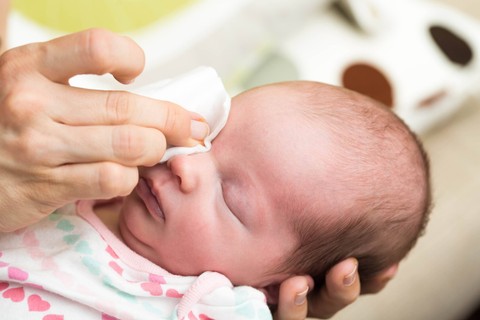 Ilustrasi kemerahan di mata bayi. Foto: Shutterstock