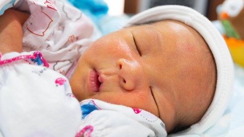 Ilustrasi penyakit kuning pada bayi. Foto: Bonn_A/Shutterstock