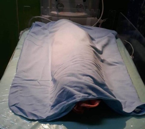 Bayi Laki-laki yang Diduga Dibuang di Mamuju Meninggal di Rumah Sakit