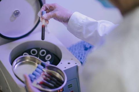 Apa itu Centrifuge di Laboratorium? Ini Jawabannya yang Perlu Diketahui (1)