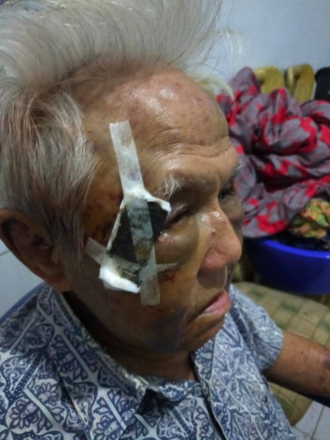 Korban penganiayaan anak kandung di Tambora, Jakarta Barat. Foto: Dok. Istimewa