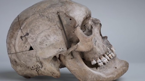 Kepala Charles Byrne, manusia raksasa dari Irlandia. Foto: YouTube/Ronan McCloskey