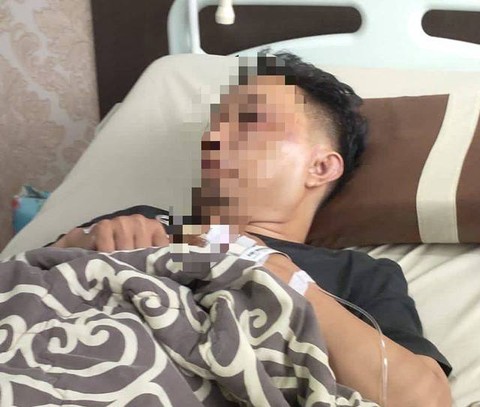 Taufik Hidayat mengalami lebam dan patah hidung setelah diculik dan dikeroyok oleh mahasiswa. Foto: Dok Hi!Pontianak