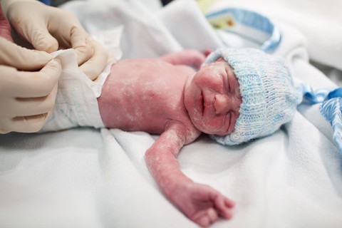Vernix caseosa pada bayi baru lahir. Foto: Shutterstock