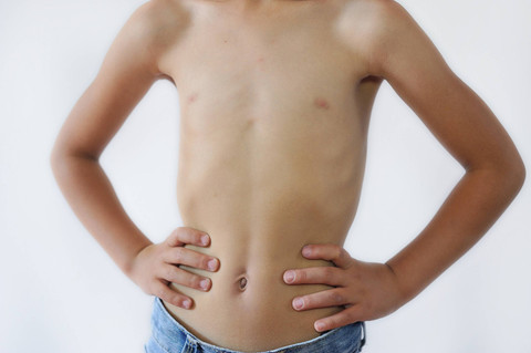 Ilustrasi Anak Bertubuh Kurus. Foto: Ketolina/shutterstock
