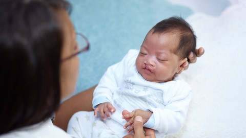 Ilustrasi Bayi dengan Bibir Sumbing. Foto: Yuri A/Shutterstock