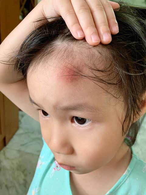 Ilustrasi kepala anak benjol. Foto: DaViDa S/Shutterstock