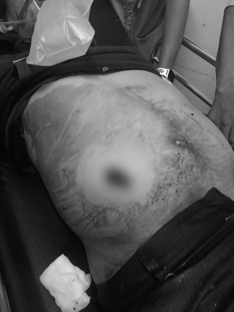 Korban tewas dikeroyok dan ditusuk dalam hotel di Makassar, Sabtu (29/7). Foto: Dok. Istimewa