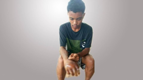 Kondisi siswa di Kabupaten Flores Timur, NTT, yang tangannya dicelupkan ke air mendidih oleh guru. Foto: Dok. Istimewa