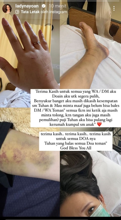 IG Story Lady Nayoan. 