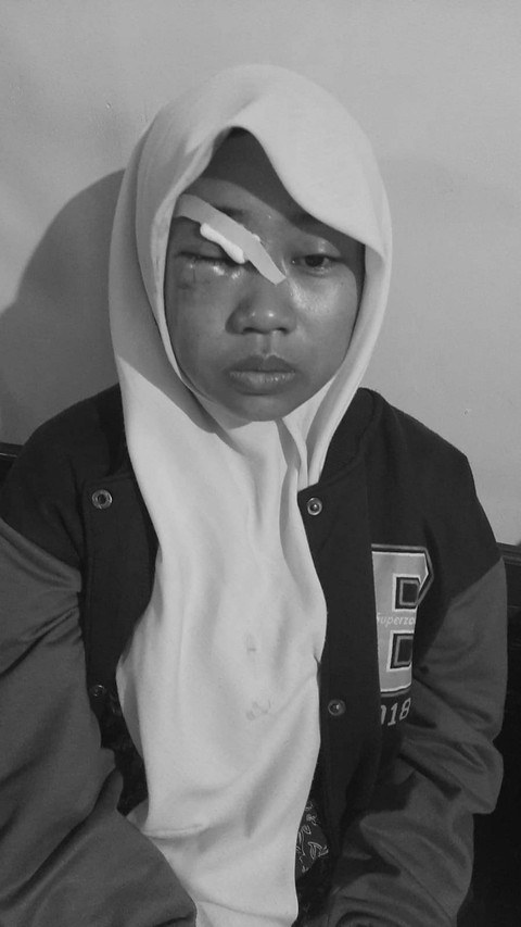 Siswi SMKN Purwosari, Kabupaten Pasuruan, yang dibekap, dipukul, dan dirampok. Dok: Istimewa