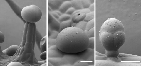 Kiri ke kanan: Trichomes kelenjar tanaman ganja yang bertangkai, sesil, dan bulat.  Foto: Samuel Lab/ University of British Columbia (UBC)