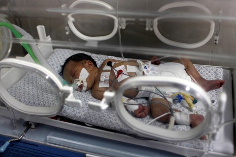 Seorang bayi Palestina di inkubator di Rumah Sakit Nasser di Khan Yunis di Jalur Gaza selatan pada 27 Juli 2014. Foto: Said Khatib/AFP