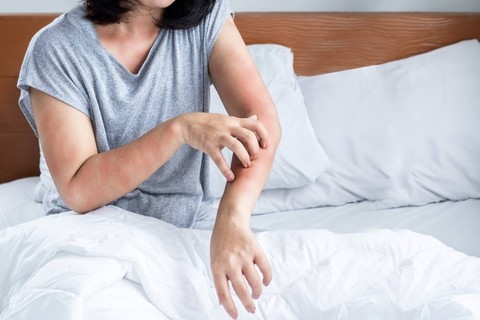 Ilustrasi digigit kutu kasur. Foto: Doucefleur/Shutterstock