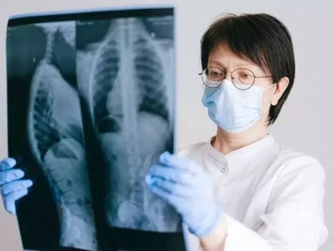 Ilustrasi dokter memeriksa hasil rontgen paru-paru pasien TBC. Foto: Pexels
