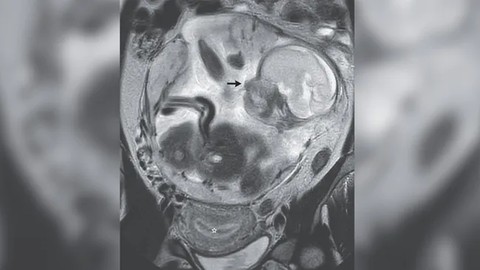The New England Journal of Medicine
