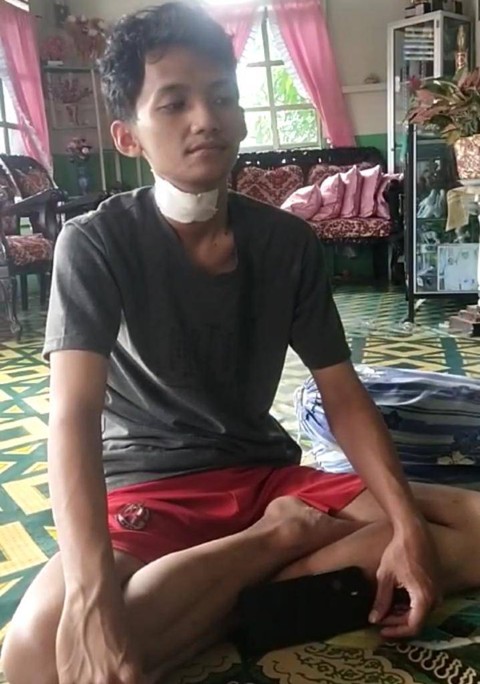 Erdy, warga Pontianak Utara yang terjerat tali layangan dan harus mendapat 6 jahitan di lehernya. Foto: Dok. Hi!Pontianak