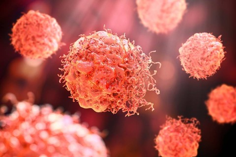 Ilustrasi sel kanker. Foto: Shutterstock