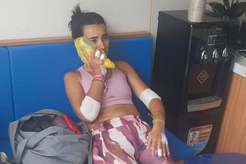 Dua turis Spanyol terluka parah kena jambret emas imitasi di Bali. Foto: Polresta Denpasar