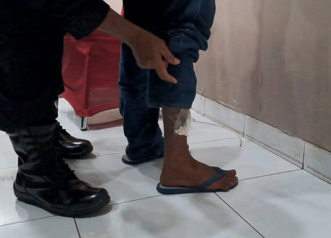 Pil koplo dilakban di kaki. Dok: Lapas Kelas IIA Yogyakarta