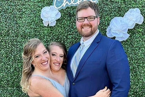 Kembar siam Brittany dan Abby Hensel  dengan Josh Bowling. Foto: Facebook