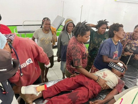 Anak anak jadi korban baku tembak di Intan Jaya, Papua, Senin (8/4/2024) Foto: Dok. Satgas Damai Cartenz.