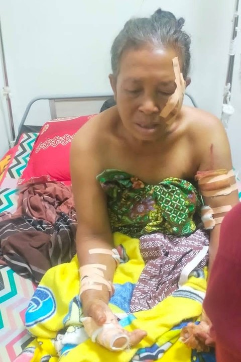 Kondisi para korban yang diserang babi hutan di Desa Sembalun, Lombok Timur. Foto: Dok Polres Lotim