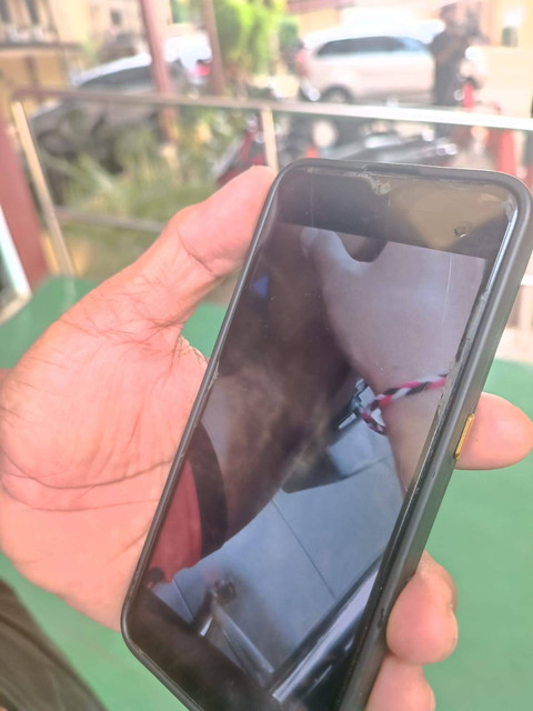 Layar handphone yang menampilkan luka lebam di tubuh korban penganiayaan di STIP. Foto: Dok. Istimewa