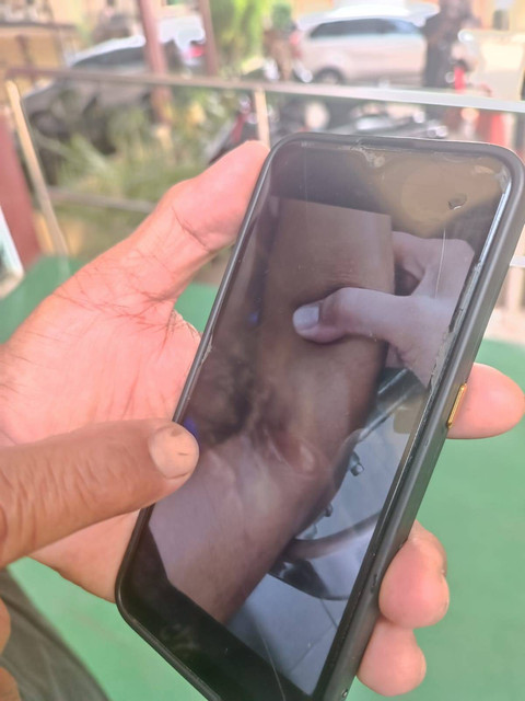 Layar handphone yang menampilkan luka lebam di tubuh korban penganiayaan di STIP. Foto: Dok. Istimewa