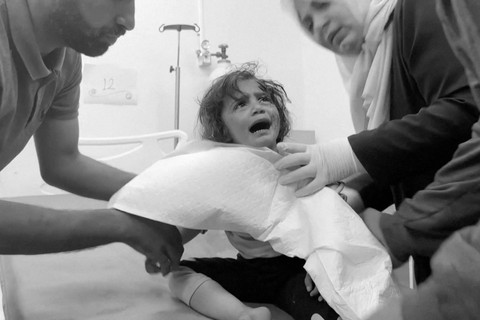 Seorang anak Palestina, yang terluka dalam serangan Israel di daerah yang diperuntukkan bagi para pengungsi, dibantu di rumah sakit saat perang di Gaza berlanjut, di Rafah di Jalur Gaza selatan (26/5/2024). Foto: REUTERS melalui REUTERS TV