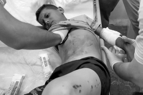 Seorang anak Palestina, yang terluka dalam serangan Israel di daerah yang diperuntukkan bagi para pengungsi, dibantu di rumah sakit saat perang di Gaza berlanjut, di Rafah di Jalur Gaza selatan (26/5/2024). Foto: REUTERS melalui REUTERS TV