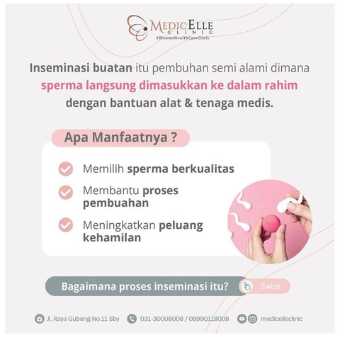 Mengenal Inseminasi Buatan, Apa Bedanya dengan Bayi Tabung? (1)