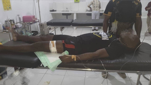 Prajurit TNI mengalami luka tembak di kaki akibat diserang KKB di Yahukimo, Papua Pegunungan. Foto: Dok. Istimewa