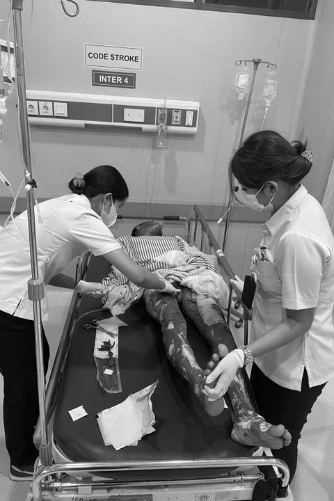 Gudang LPG di Bali terbakar. Foto: Dok. Istimewa