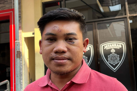 Farid sopir pengusaha Surabaya yang juga menjadi korban pengeroyokan sejumlah orang saat menunjukkan luka. Foto: Intan Alliva Khansa/kumparan