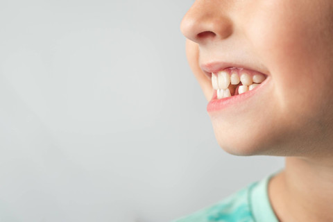 Ilustrasi Bercak Putih pada Gigi Anak Foto: Shutterstock