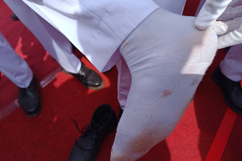 Kaki anggota Paskibra di Jember tertusuk paku payung. Foto: Mili.id