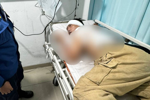 Korban kebakaran dan ledakan di Grogol, Jakarta Barat. Foto: Dok. Istimewa