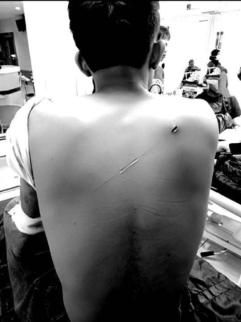 Dua remaja di Kapanewon Kasihan, Kabupaten Bantul dibacok rombongan tak dikenal saat hendak membeli rokok, Minggu (15/9/2024) dini hari. Foto: Dok. Polres Bantul