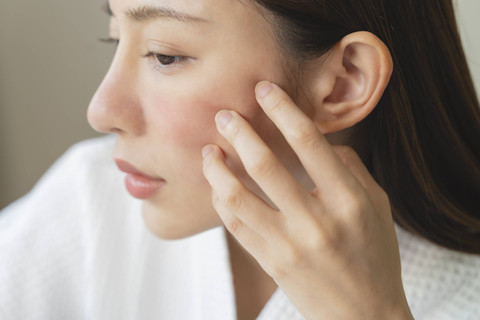 Ilustrasi eksim. Foto: Pormezz/Shutterstock 