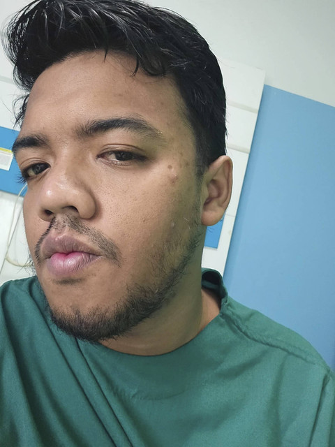 R. Bagas Priyo Bimantoro sebelum menjalani operasi amandel di RSI Siti Hajar Sidoarjo. Foto: Dok. Istimewa