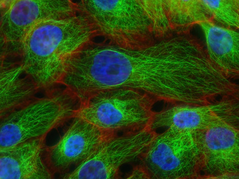 Ilustrasi Pembelahan Mitosis Terjadi Pada Sel, Sumber Unsplash  National Cancer Institute