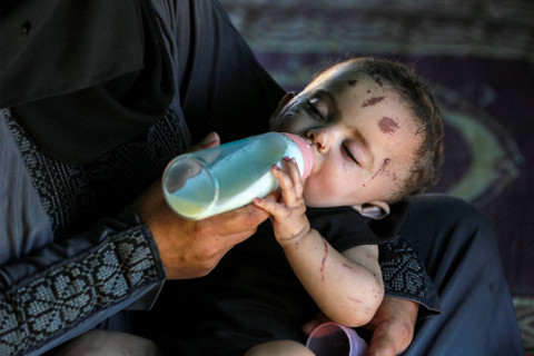 Ilustrasi Balita yang selamat dalam serangan Israel di Gaza Foto: Bashar Taleb/AFP
