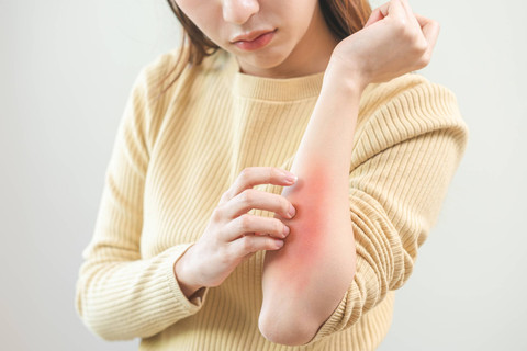 Ilustrasi kulit wanita gatal. Foto: Shutterstock