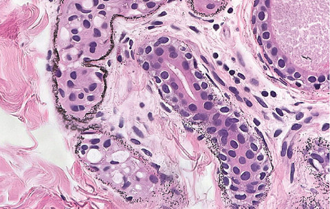 Konsentrasi perak dalam darah pasien. Foto: Lee et al., NEJM, 2024