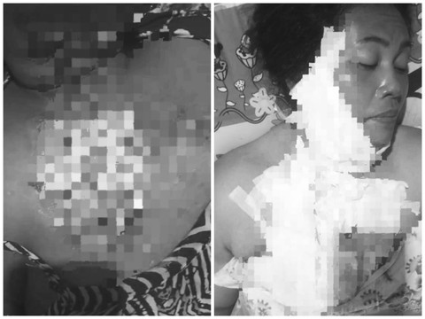 Korban yang dibakar oleh pelaku. | Foto: Ist