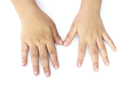 Ilustrasi kuku anak. Foto: Photo Win1/Shutterstock